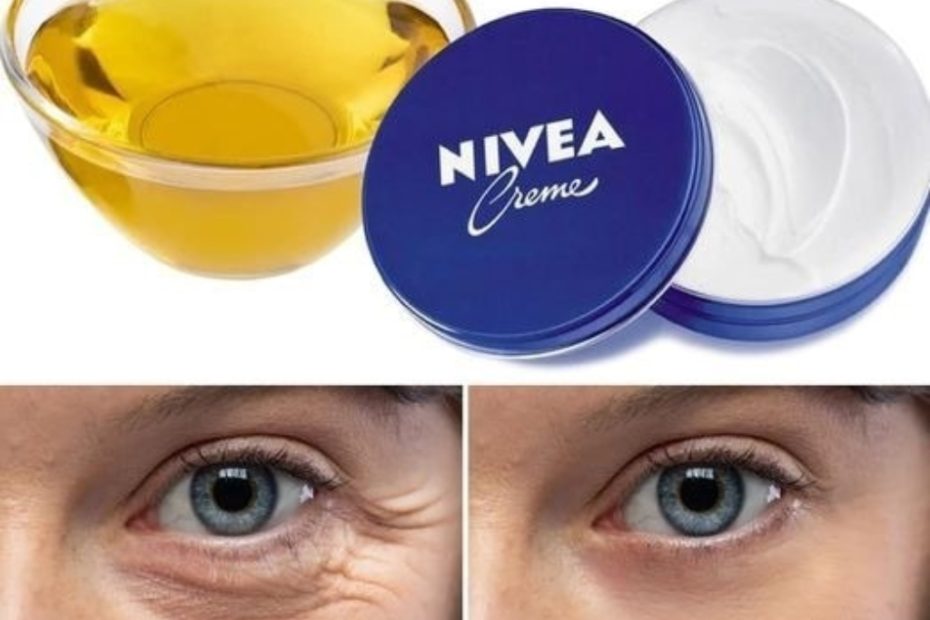 Creme Nivea e azeite a poderosa solucao contra manchas, rugas e linhas de expressao
